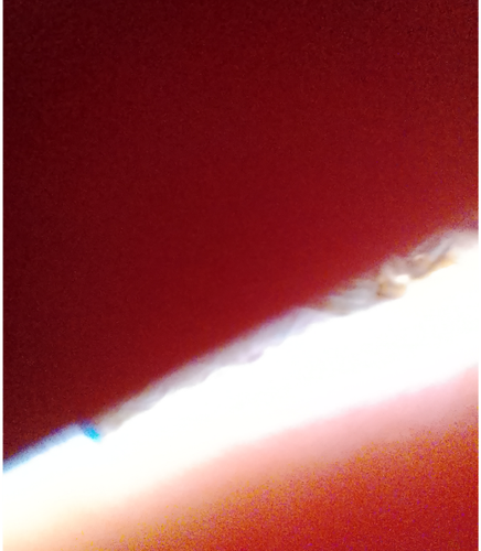 temp.png