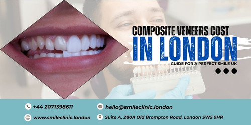 Composite Veneers Cost Guide for a Perfect Smile UK.jpg