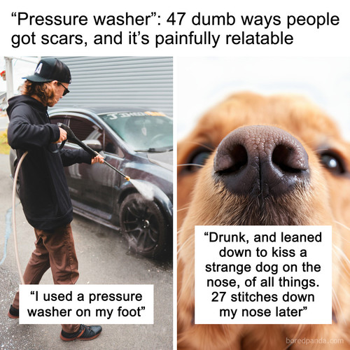 stupidest injuries scar stories.jpg