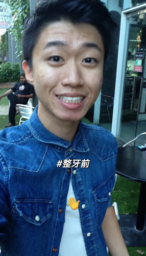 牙齿整齐测试图20 亚裔.jpg
