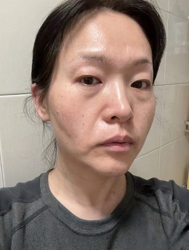 微笑唇测试图23 亚裔.jpg