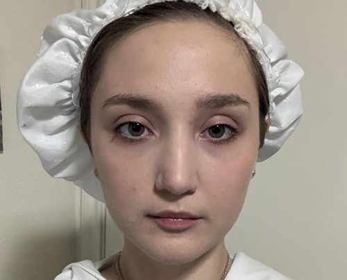what can i do about my uneven eyes v0 in156jf9sl5f1.jpg