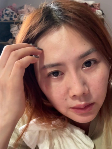 40岁老阿姨大小眼怎么治（好明显） 1 张大米 来自小红书网页版.jpg