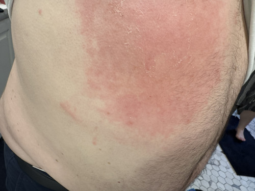Stomach Day 8 of Doxy new line mark at bottom side separate.jpg