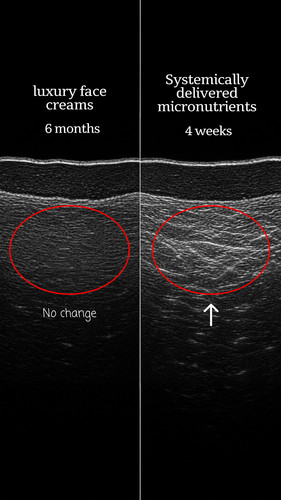 xray v1 9x16 ENG.jpg