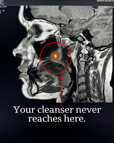 xray v3 4x5 ENG.jpg