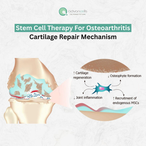 Stem cell therapy for osteoarthritis...jpg