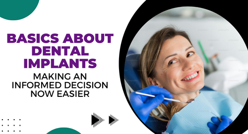 Basics about dental implants making an informed decision now easier.png