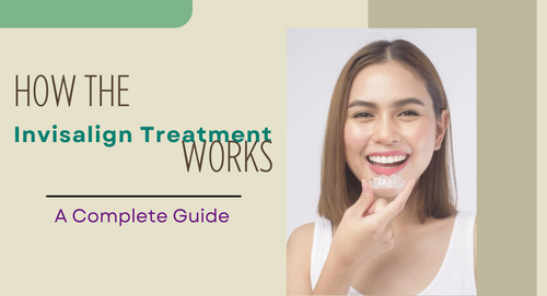 How the Invisalign Treatment Works A Complete Guide.png