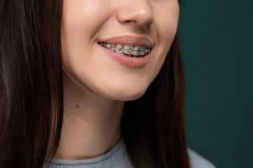 BRACES.webp