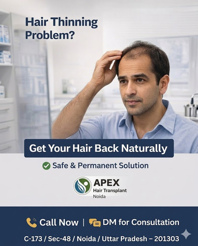 Hair thinning problem.jpg