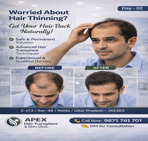 Hair restoration solutions.jpg