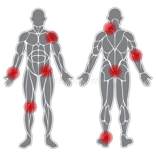 human weak joints body silhouette muscles sore spots 81967429.jpg