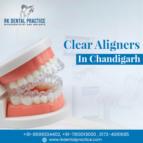 Clear Aligners in Chandigarh for Invisible Teeth Straightening.jpg