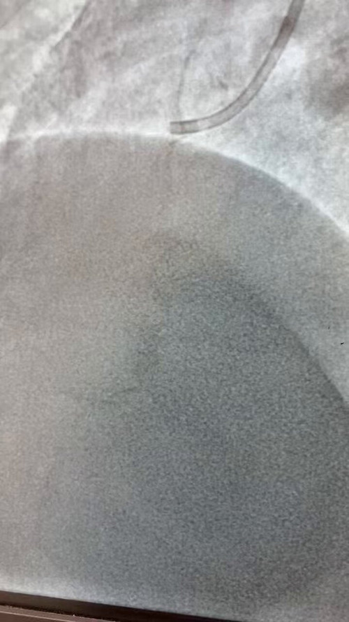 AxSUliMyaE6 9OSt.jpg