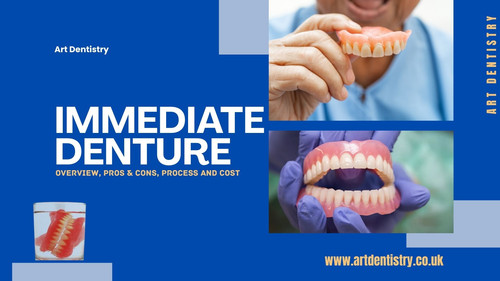 Immediate Denture Overview, Pros & Cons, Process and Cost (2).jpg