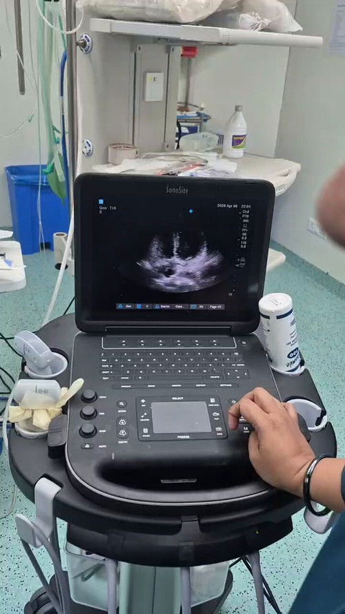 1jwtmvw7Lxn7 XFv.jpg