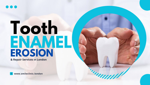Tooth Enamel Erosion & Repair Services in London.jpg
