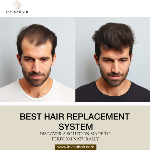 Best Hair Replacement System.png