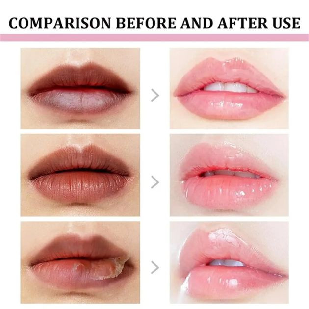 👉 Korean Lip Balm – Remove Dark Lips & Get Soft Pink Lips Fast!