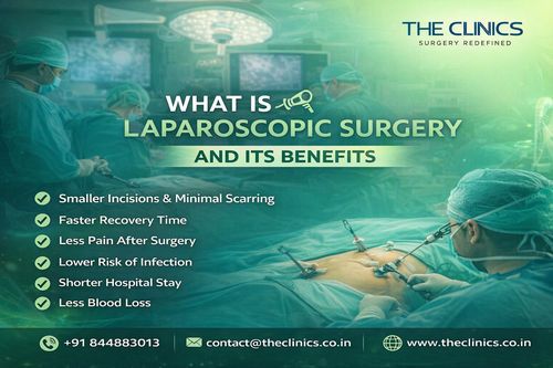What Is Laparoscopic Surgery and Its Benefits.png