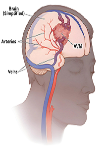 sidharthvascular.com.png
