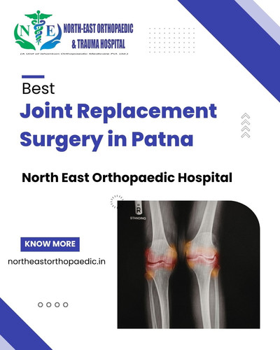 Best Joint Replacement Surgery in Patna: North East Orthopaedic Hospital.jpg