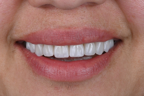 8f48e937136d.jpg