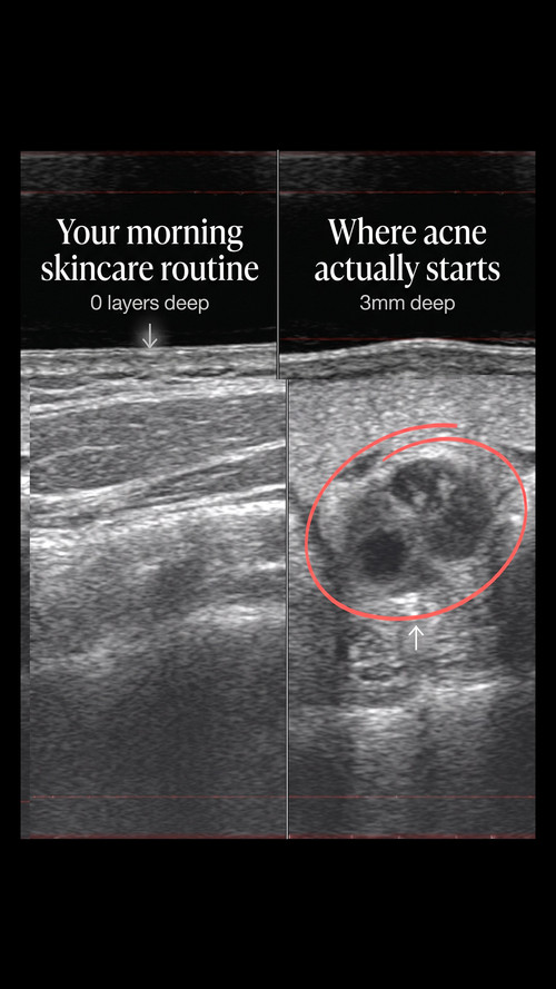 xray v2 9x16 ENG.jpg