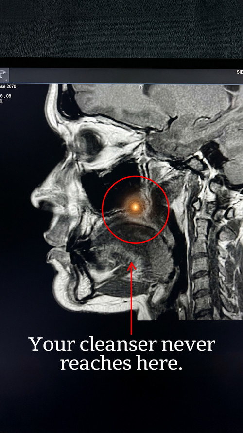 xray v3 9x16 ENG.jpg