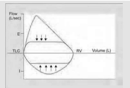 flow volume loop.png