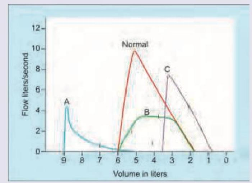 flow volume loop2.png