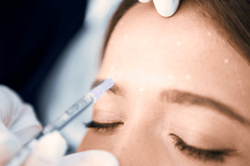 Advanced Wrinkle Relaxation with Xeomin.png