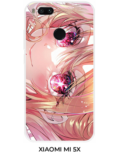 3 Xiaomi MI 5X.png
