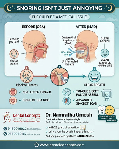 SNORING ISN’T JUST ANNOYING – IT COULD BE A MEDICAL ISSUE.jpg