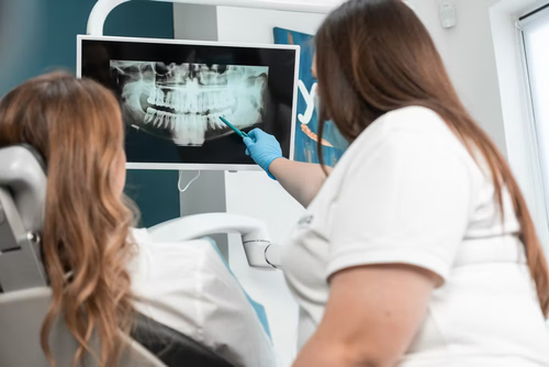 full arch dental implants.png