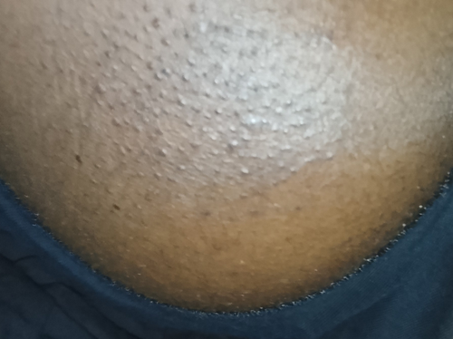 temp.png