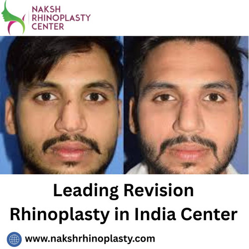 Leading Revision Rhinoplasty in India Center.jpg