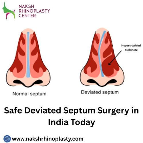 Safe Deviated Septum Surgery in India Today.jpg