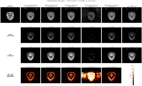 P 4e281a458 ONCO MR 2c7c362f v1 v3 v31 v4 v5.png