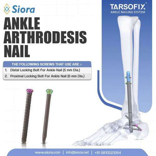 Ankle Arthrodesis Nail.jpg