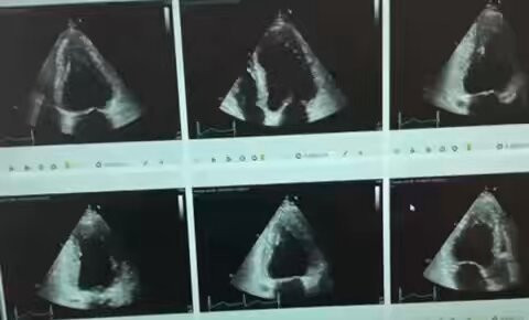 0Z6T11x UNG8Yy9s.jpg