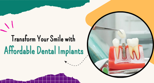 Transform Your Smile with Affordable Dental Implants.png