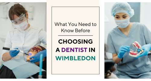 What You Need to Know Before Choosing a Dentist in Wimbledon.png