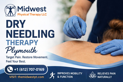 Dry Needling Therapy Plymouth.jpg