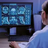 Creierul nu este egal: care zone se deteriorează mai repede?