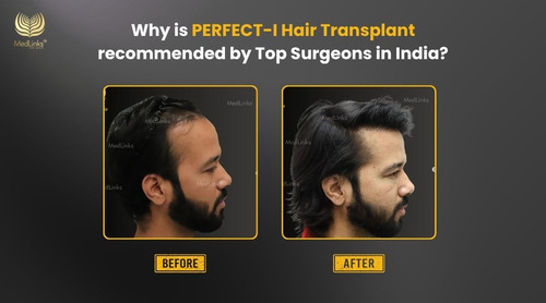 Get Advanced Perfect-i Hair Transplant in Delhi with MedLinks.jpg