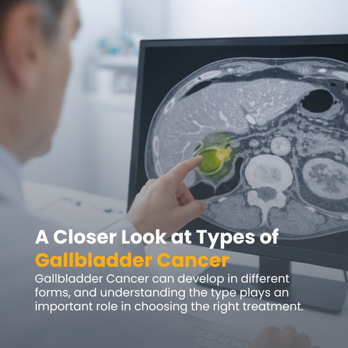 A Closer Look at Types of Gallbladder Cancer.jpg
