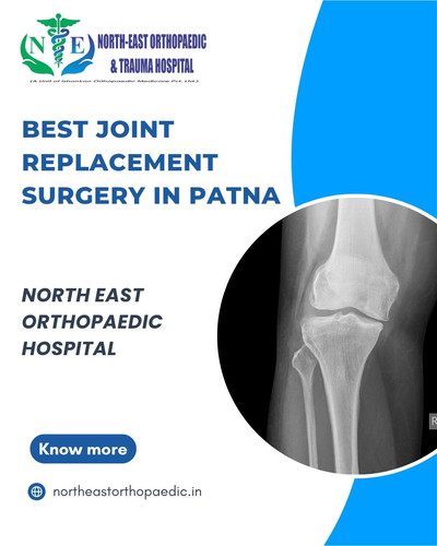 Best Joint Replacement Surgery in Patna: North East Orthopaedic Hospital.jpg