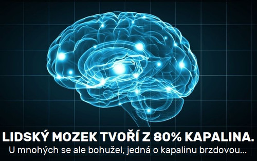 shutterstock mozek 294471983.jpg